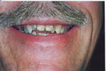 Aesthetic Dentistry - Louisvulle, KY